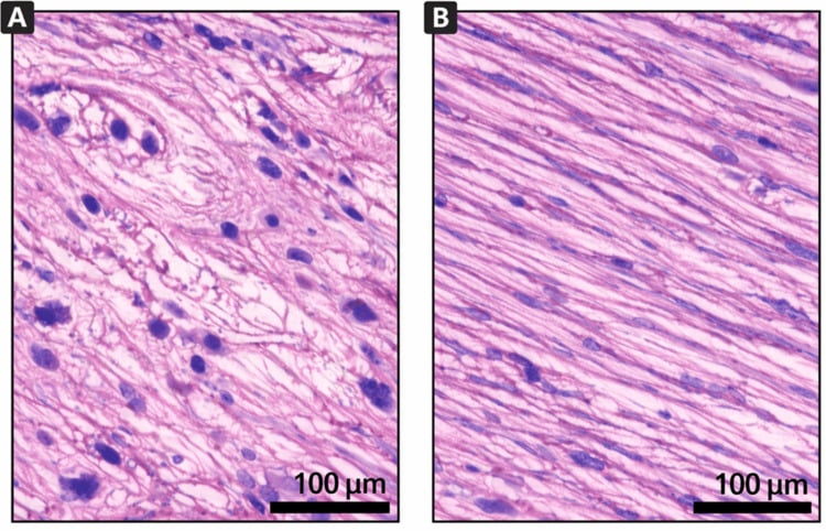 Histological comparison of ATFL and CFL collagen architecture