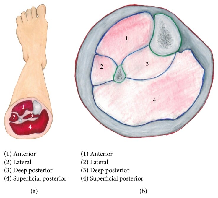 Cross-sectional anatomy of the four leg compartments