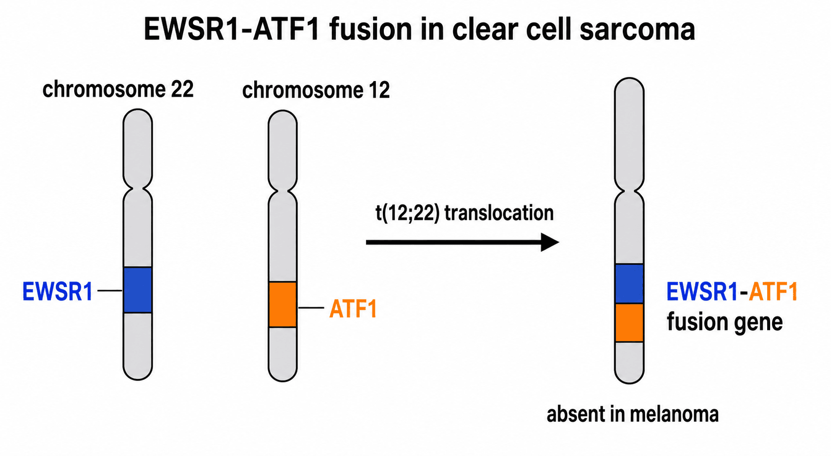 Schematic of the EWSR1-ATF1 t(12;22) gene fusion that defines clear cell sarcoma