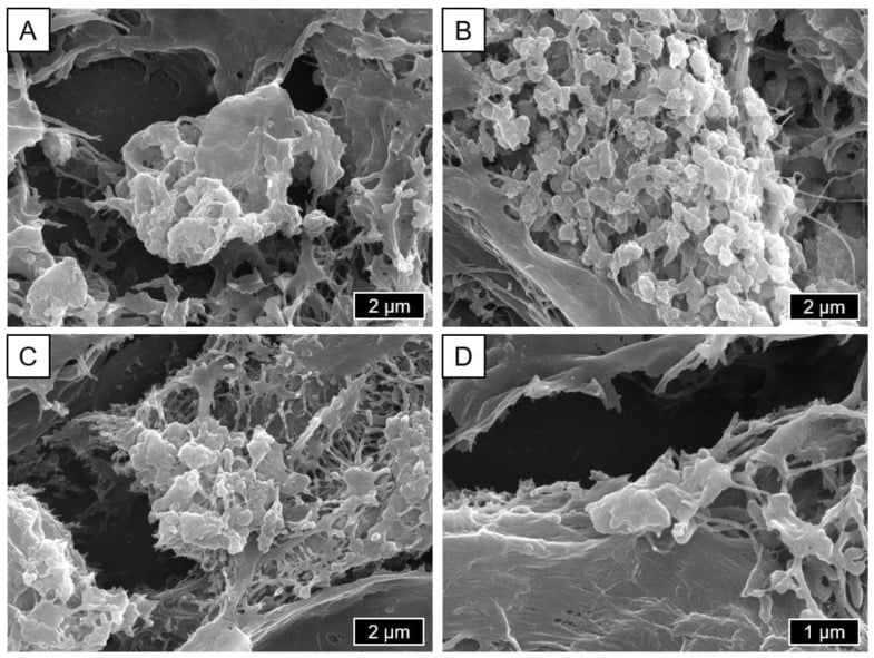 SEM of CoCrMo particle agglomerates retrieved from periprosthetic tissue