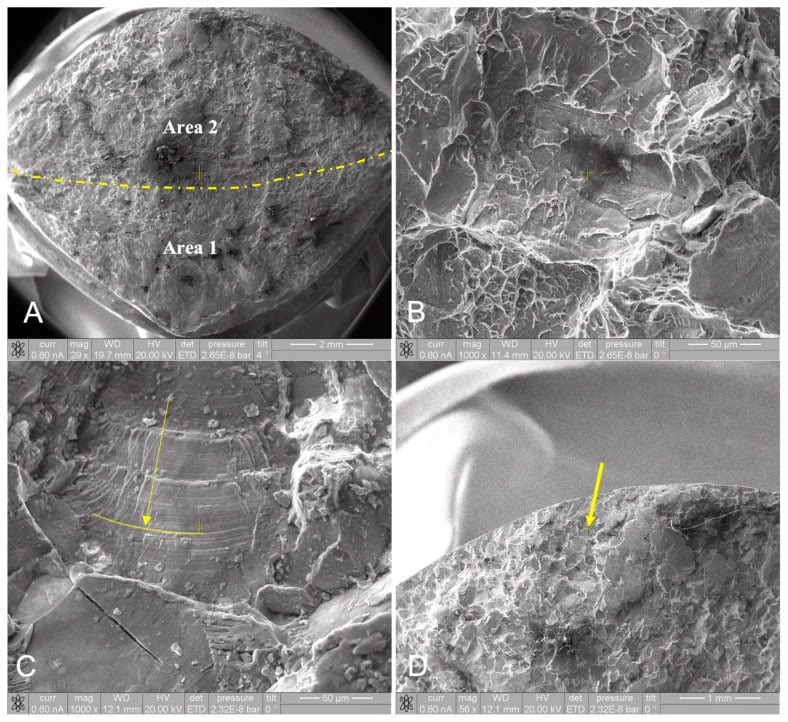 SEM of a fractured CoCr taper, the fracture surface divided into Area 1 and Area 2, with higher-magnification views