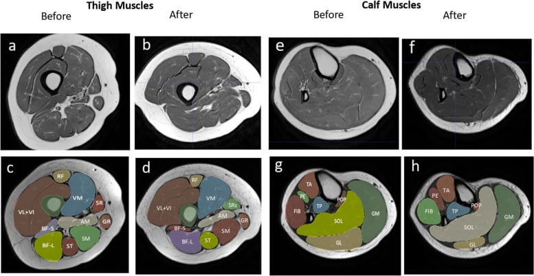 Cross-sectional MRI of thigh and calf muscle compartments