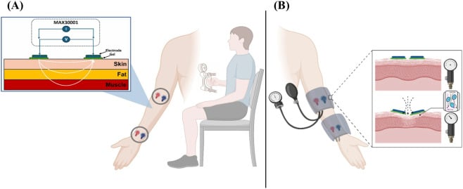 Schematic diagram of non-invasive compartment pressure monitoring setup
