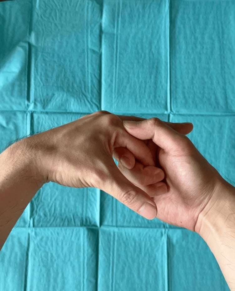 Reduction of a dorsal index metacarpophalangeal dislocation with the wrist held in slight flexion and pressure applied at the base of the proximal phalanx