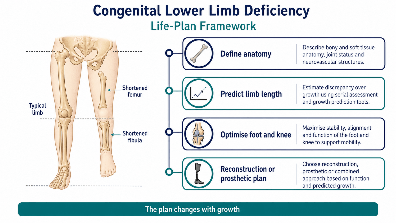 Congenital lower limb deficiency management pathway showing anatomy definition, limb length prediction, foot and knee optimisation, reconstruction or prosthetic plan