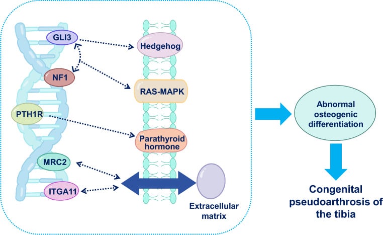 Schematic of NF1, RAS-MAPK, hedgehog and parathyroid hormone signalling converging on abnormal osteogenic differentiation