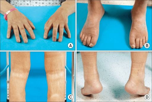 Imaging demonstrating contrast enhancement patterns in musculoskeletal pathology