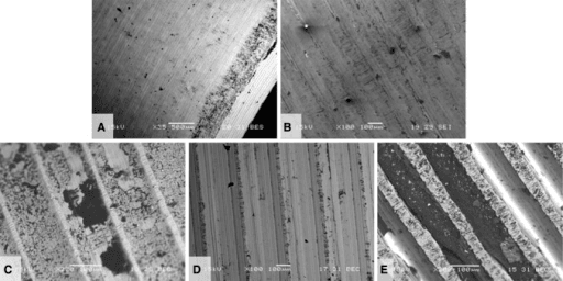 5-panel SEM images of hip femoral taper trunnion surfaces