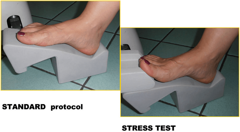 Foot positioned for the standard MRI protocol and for the stress test with the lesser MTP joints hyperextended