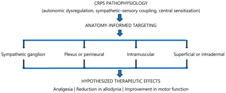 Conceptual CRPS framework linking autonomic dysregulation, sympathetic-sensory coupling and central sensitisation to anatomical neuromodulation targets