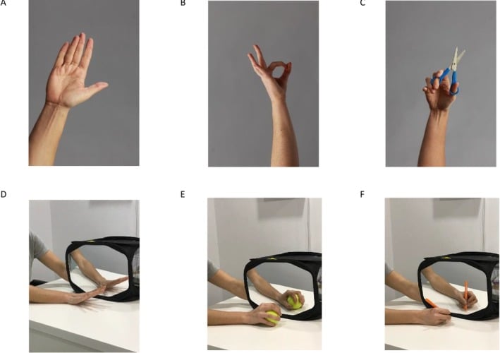 Six-panel example of laterality recognition explicit motor imagery and mirror-therapy progression