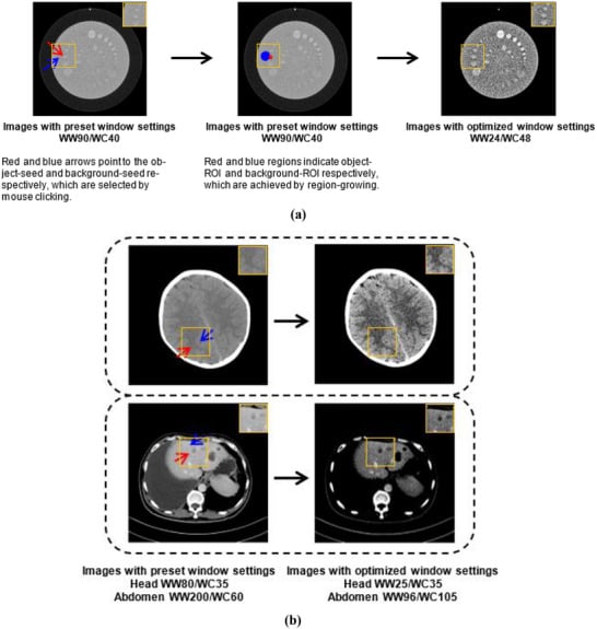 Axial CT images demonstrating preset vs optimized windowing for head and abdomen