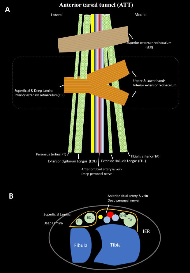 Anatomical illustration of anterior tarsal tunnel and deep peroneal nerve course