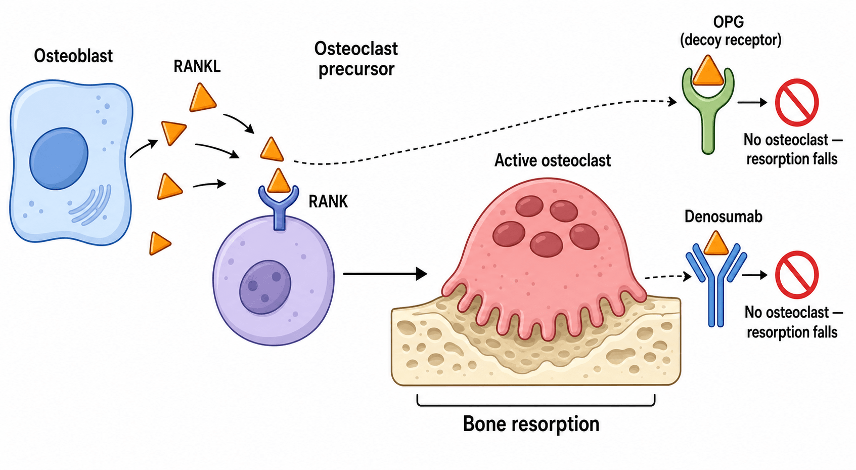 Schematic of the RANK/RANKL/OPG signalling axis: osteoblast-derived RANKL binds RANK on an osteoclast precursor to form an active osteoclast resorbing bone, while OPG and the antibody denosumab each bind the RANKL ligand to block this.