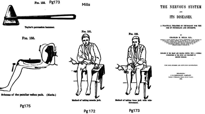 Historical clinical illustrations showing the patellar tendon reflex, reinforcement with the Jendrassik manoeuvre and the reflex arc.
