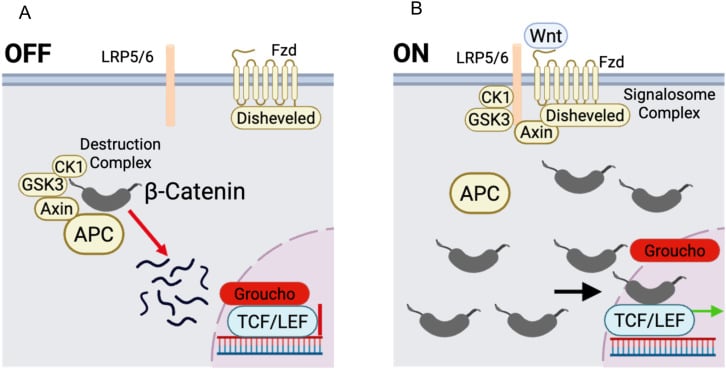 Schematic diagram of the Wnt and beta-catenin signaling pathway in desmoid tumor pathophysiology