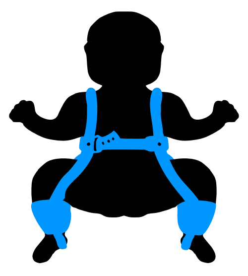 Diagram of Pavlik harness showing straps and positioning on infant