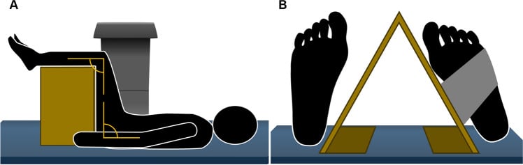 Patient positioning for DXA with hips and knees flexed to ninety degrees for lumbar scanning and the hip internally rotated for proximal femur scanning.