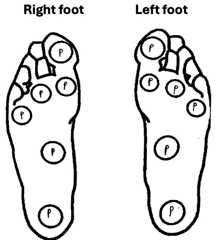 Plantar diagrams of the right and left foot showing the standard monofilament test sites