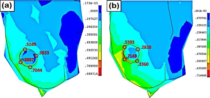 Plantar pressure maps comparing barefoot walking with therapeutic footwear and custom insoles