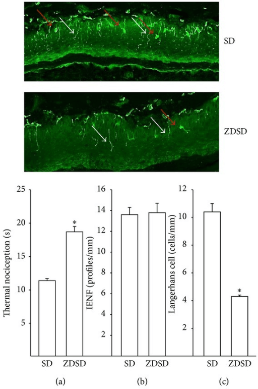 Immunofluorescence of skin from control and diabetic rats with bar graphs of thermal nociception, intra-epidermal nerve fibre density and Langerhans cell density.
