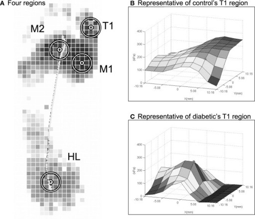 Representative plantar pressure maps and three-dimensional pressure surfaces for a control and diabetic first-toe region