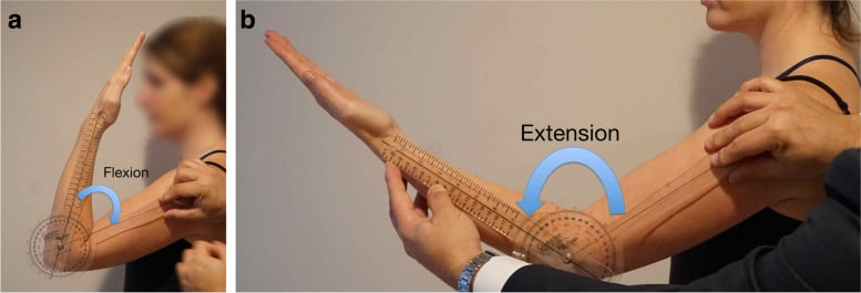 Goniometric assessment of elbow flexion and extension