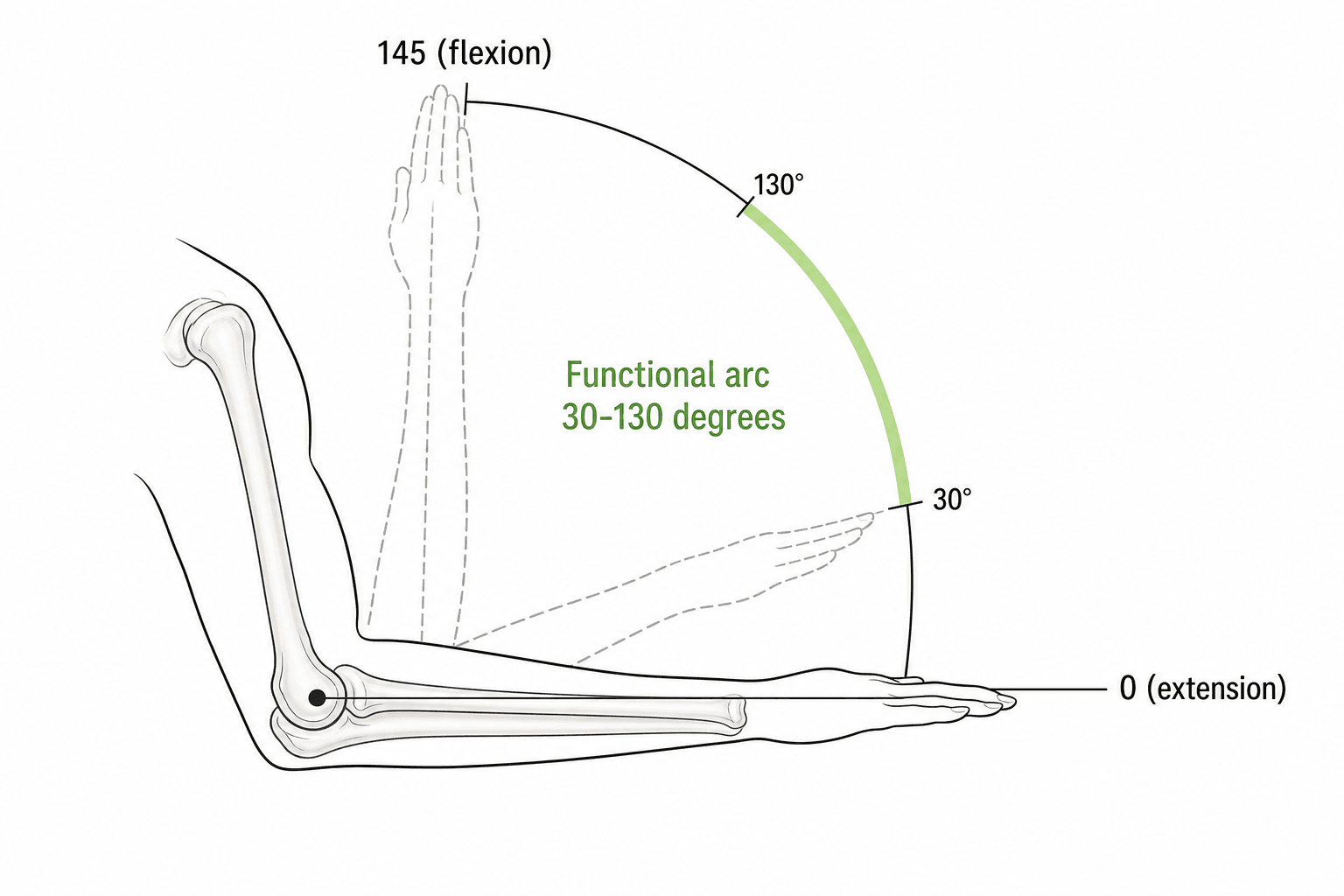 Schematic of elbow flexion-extension showing the functional arc between 30 and 130 degrees