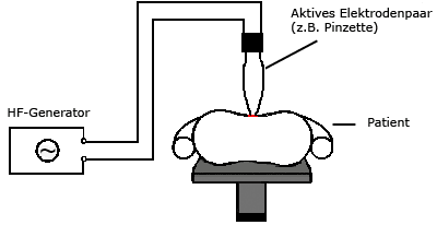 Bipolar diathermy circuit diagram
