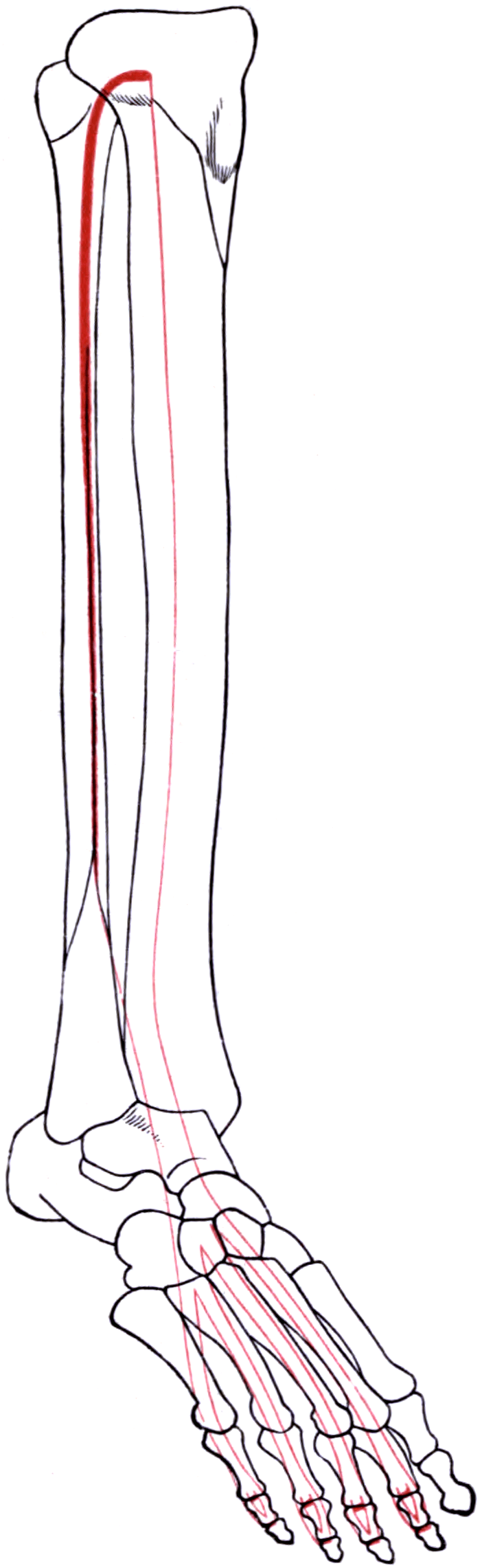Outline drawing of the leg and foot bones with extensor digitorum longus marked in red from its origin on the upper tibia and fibula to four tendons to the lateral toes