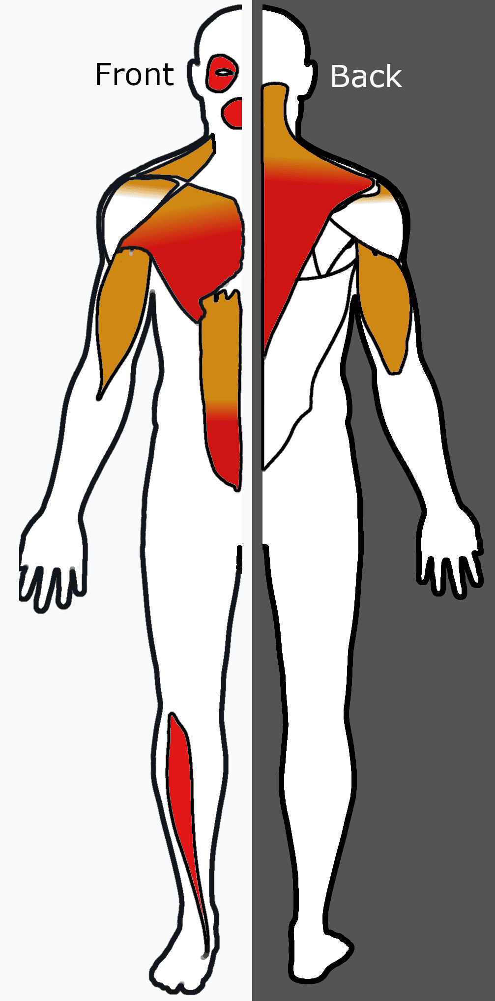 Diagram of the front and back of the body showing the muscle groups commonly involved in FSHD highlighted in red