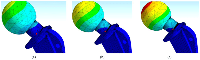 Three finite-element views of a hip stem with the crack site marked at the neck