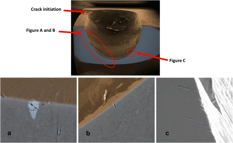 SEM fractography showing microcracks at an introducer hole