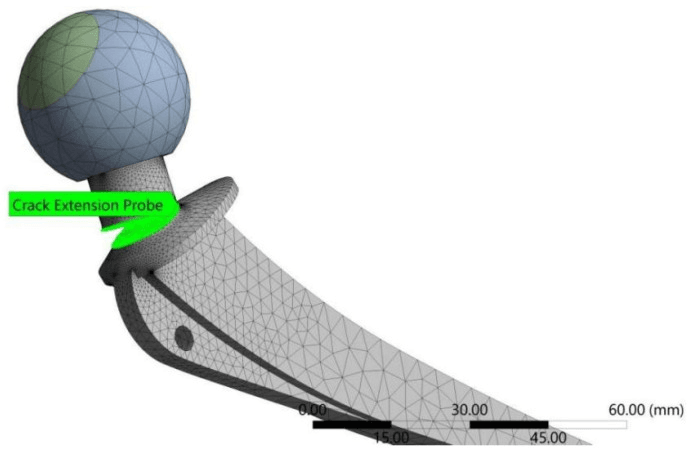 Finite-element hip stem model with a crack extension probe at the neck