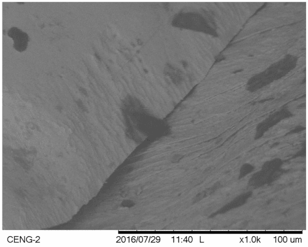 Scanning electron micrograph of the fracture site of a failed implant