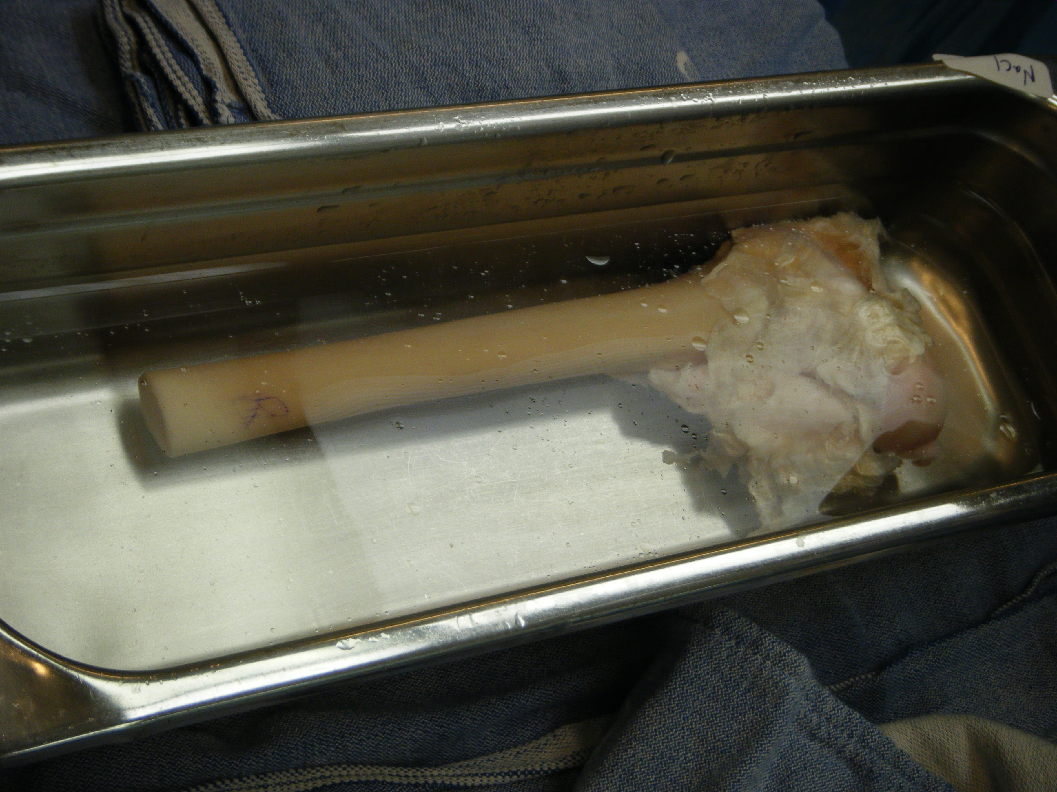 Photograph of a human upper femur bone allograft with associated soft tissues in a stainless steel tray.
