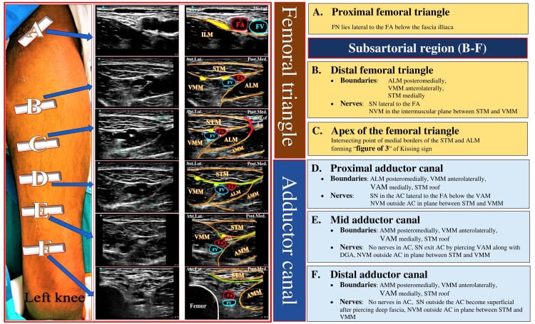 Surface anatomy and ultrasound landmarks from the femoral triangle to the adductor canal