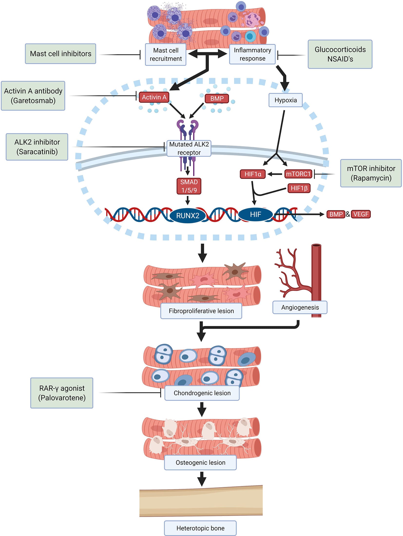 Pathophysiology diagram of fibrodysplasia ossificans progressiva showing the ALK2/Activin A/BMP pathway leading to heterotopic bone, with drug targets
