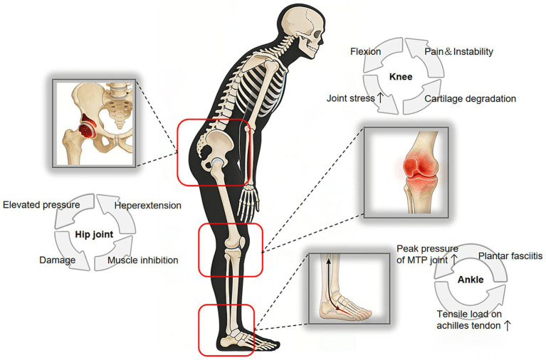 Stooped skeleton in side view with the hip, knee and ankle boxed in red, each linked to an inset joint picture and a cycle of printed labels