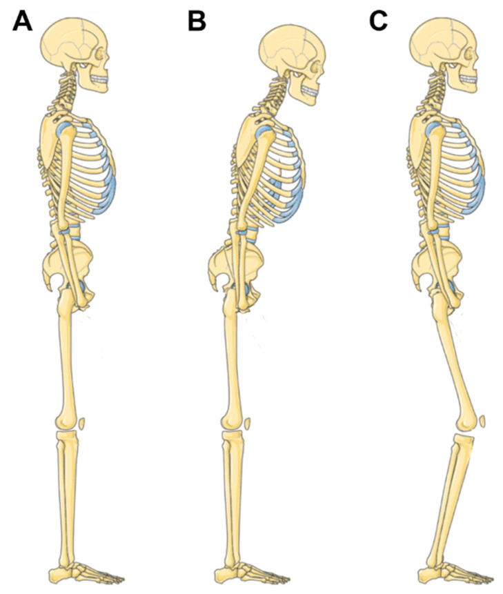 Three lateral skeleton drawings labelled A, B and C: upright; forward-leaning with the lumbar curve flattened into the thoracic kyphosis; forward-leaning with the pelvis rotated back and the knees flexed
