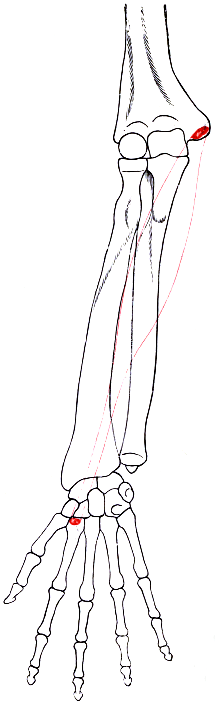 Outline drawing of the right forearm bones with the origin and insertion areas of flexor carpi radialis marked.