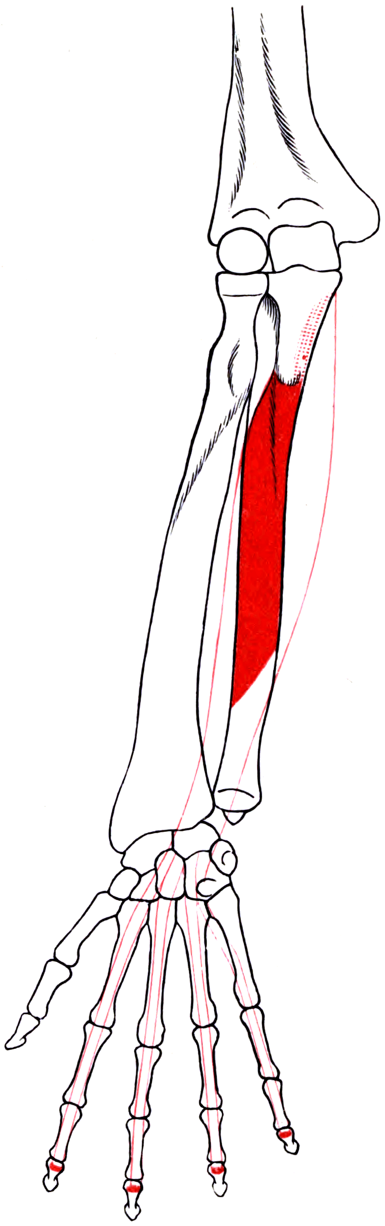 Outline drawing of the right forearm and hand bones showing the origin and insertion areas of flexor digitorum profundus.