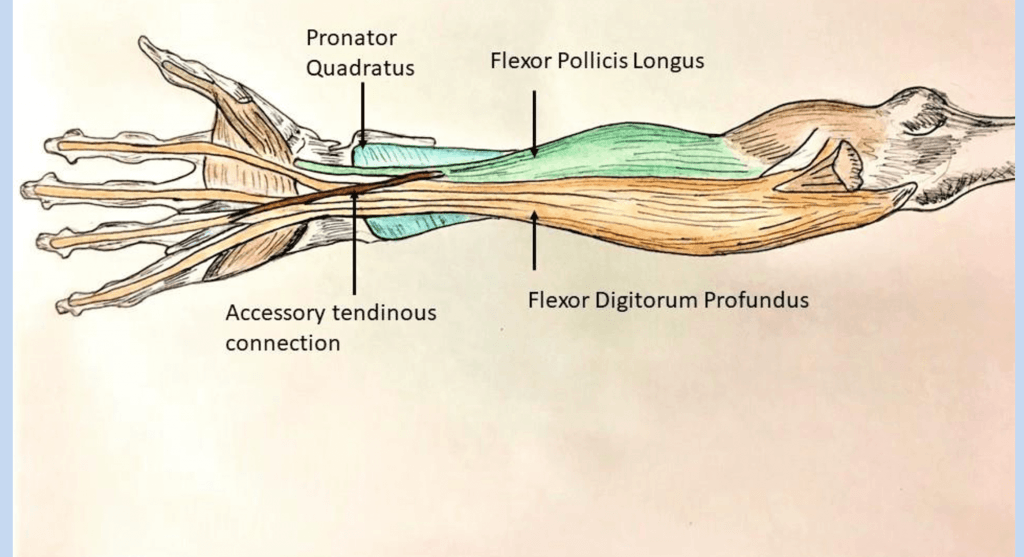 Illustration of the anterior forearm with flexor digitorum profundus shown deep to the superficial flexors.