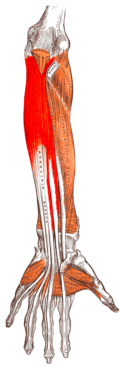 Anterior view of the right forearm with the flexor digitorum profundus muscle shaded in red among the deep flexor group.