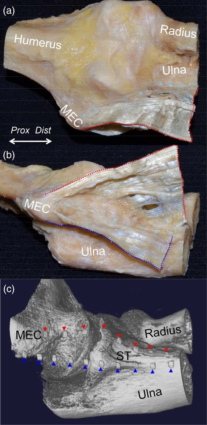 Dissection and micro-CT mapping the medial elbow tendinous complex between epicondyle and sublime tubercle