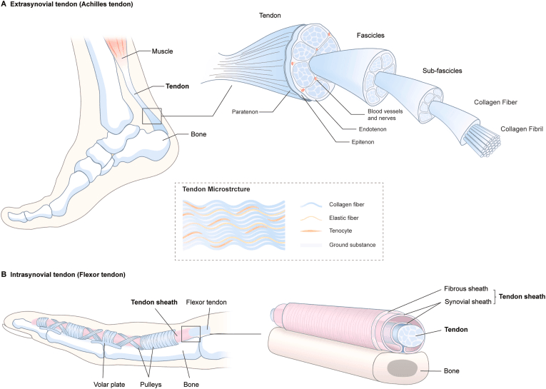 Diagram comparing extrasynovial and intrasynovial finger flexor tendon structure