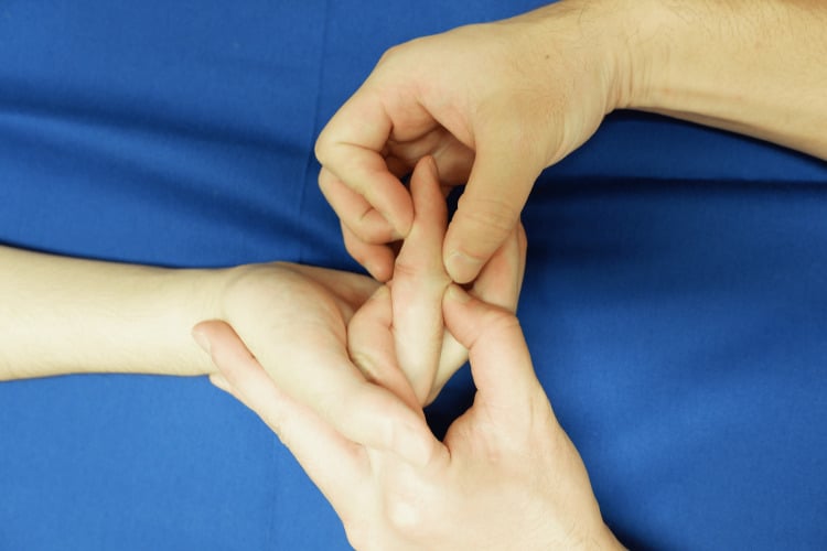 Duran passive-extension exercise after Zone I or II flexor tendon repair