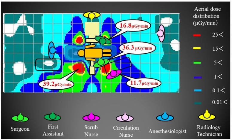 Aerial radiation-dose map at operator height showing the primary surgeon in the highest-dose zone beside the patient and progressively lower exposure with distance.