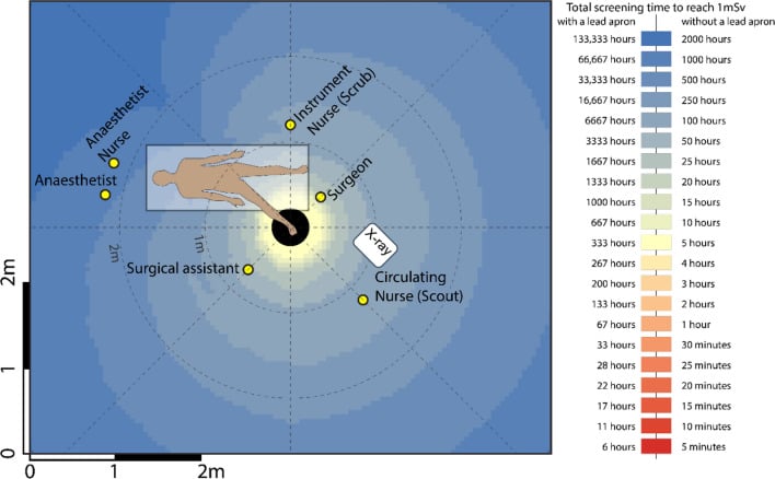Plan-view heatmap of cumulative scattered-radiation exposure around the operating table during foot surgery.