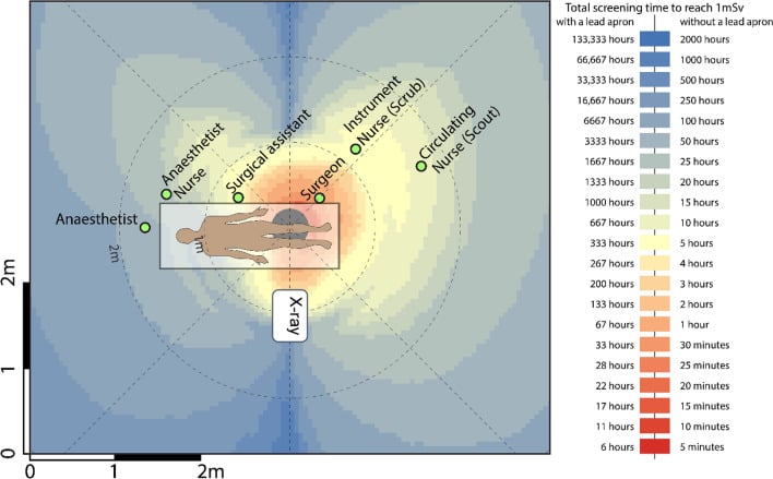 Plan-view heatmap of scattered-radiation exposure during lateral knee fluoroscopy.